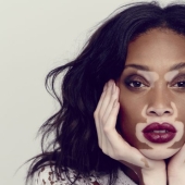 10 Girls Who Turned Their Flaws Into Strengths 10 Girls Who Turned Their Flaws Into Strengths