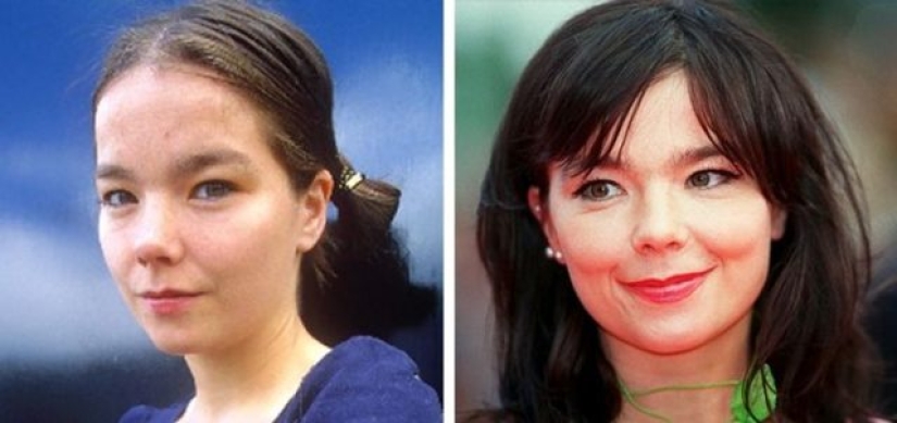 11 celebrities who proved that beauty can be different