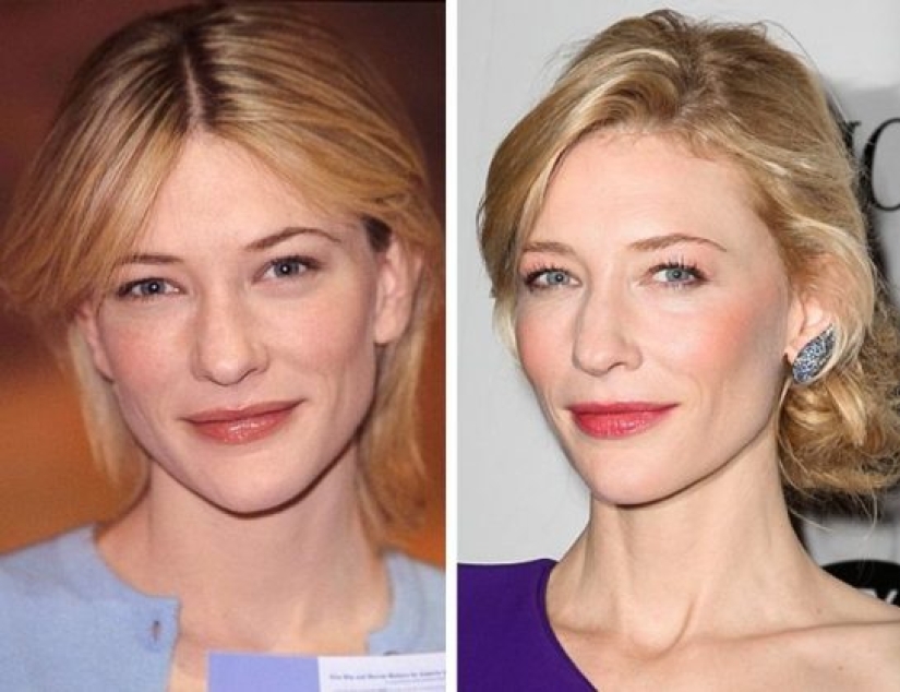 11 celebrities who proved that beauty can be different