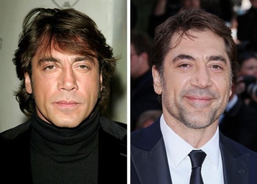 11 celebrities who proved that beauty can be different