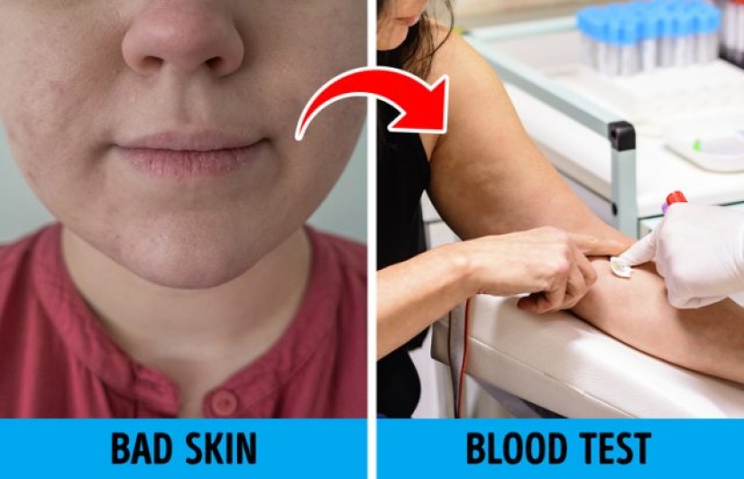 11 cosas que hacen que tu cuerpo envejezca más rápido