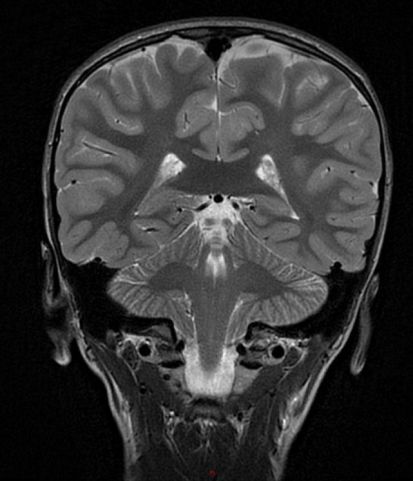 14 Things Nature Can't Show, But An X-Ray Can Show