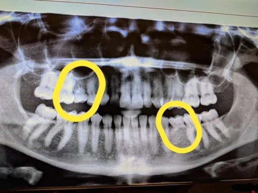 14 Things Nature Can't Show, But An X-Ray Can Show