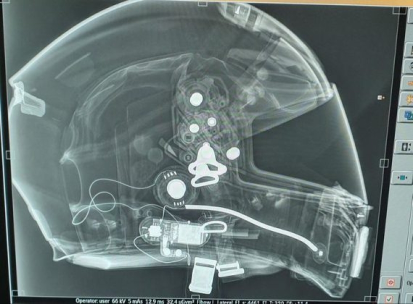 14 Things Nature Can't Show, But An X-Ray Can Show