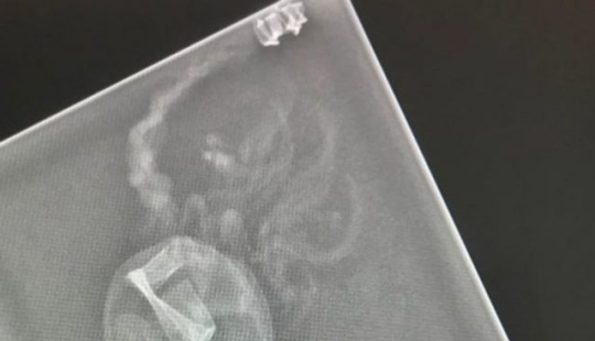 14 Things Nature Can't Show, But An X-Ray Can Show