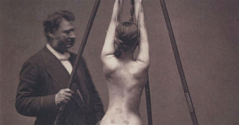 18 fotos a la vez aterradoras y fascinantes de la medicina del pasado