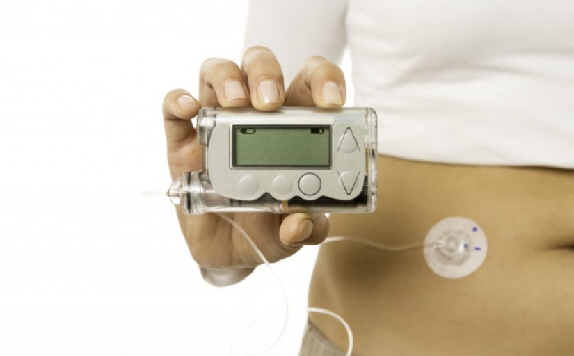 20 amazing NASA inventions that have radically changed a person's daily life 20 amazing NASA inventions that have radically changed a person's daily life