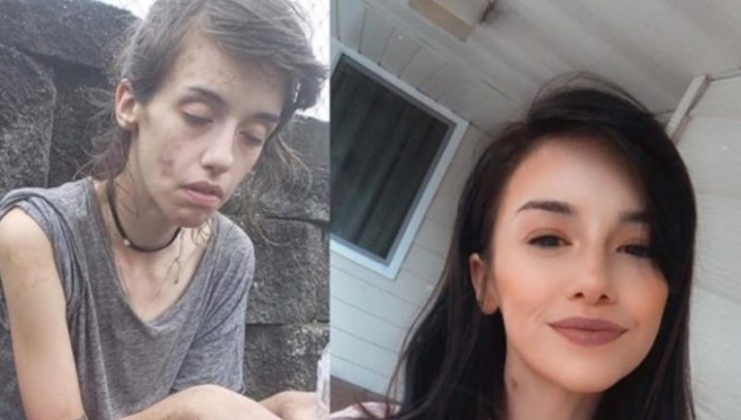 20 fotos de personas "antes y después" de cómo lograron hacer frente a la adicción 20 fotos de personas "antes y después" de cómo lograron hacer frente a la adicción
