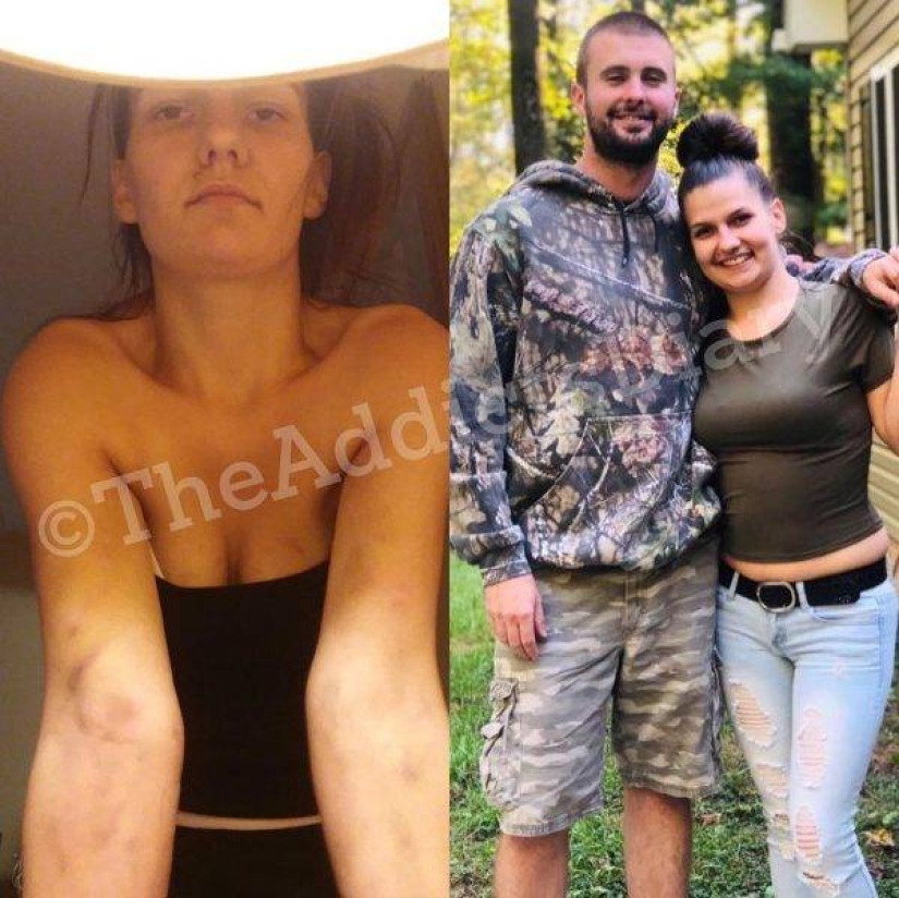 20 fotos de personas "antes y después" de cómo lograron hacer frente a la adicción 20 fotos de personas "antes y después" de cómo lograron hacer frente a la adicción