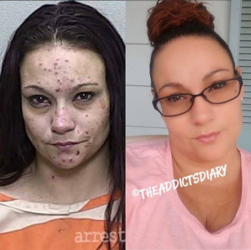 20 fotos de personas "antes y después" de cómo lograron hacer frente a la adicción 20 fotos de personas "antes y después" de cómo lograron hacer frente a la adicción