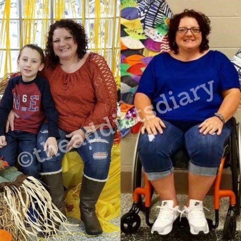 20 fotos de personas "antes y después" de cómo lograron hacer frente a la adicción 20 fotos de personas "antes y después" de cómo lograron hacer frente a la adicción