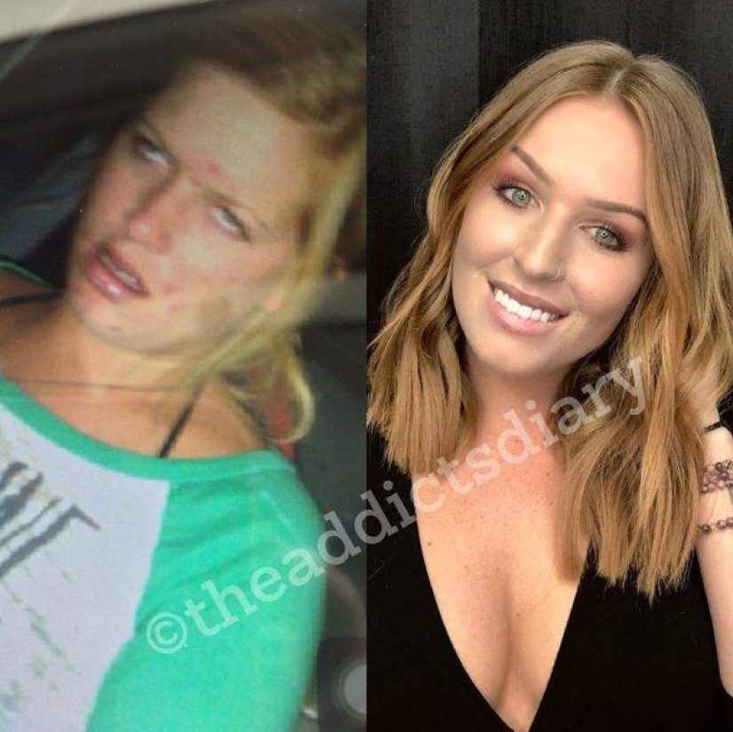 20 fotos de personas "antes y después" de cómo lograron hacer frente a la adicción 20 fotos de personas "antes y después" de cómo lograron hacer frente a la adicción