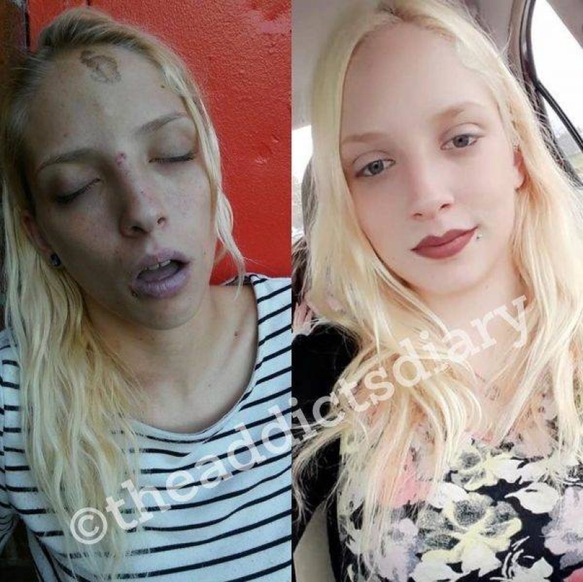 20 photos of people "before and after" how they managed to cope with addiction 20 photos of people "before and after" how they managed to cope with addiction