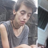20 photos of people "before and after" how they managed to cope with addiction