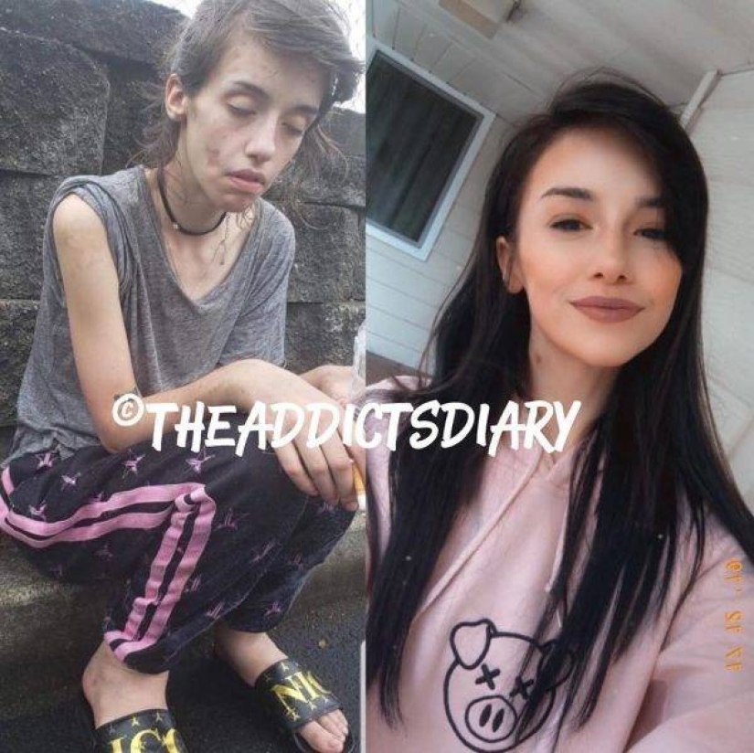 20 photos of people "before and after" how they managed to cope with addiction 20 photos of people "before and after" how they managed to cope with addiction