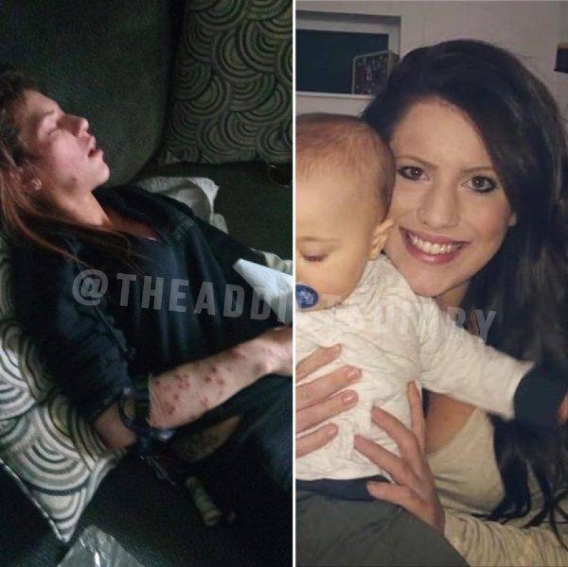20 photos of people "before and after" how they managed to cope with addiction 20 photos of people "before and after" how they managed to cope with addiction