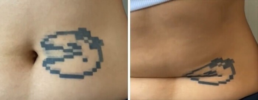 25 de los afortunados ganadores en el concurso para el estúpido tatuaje