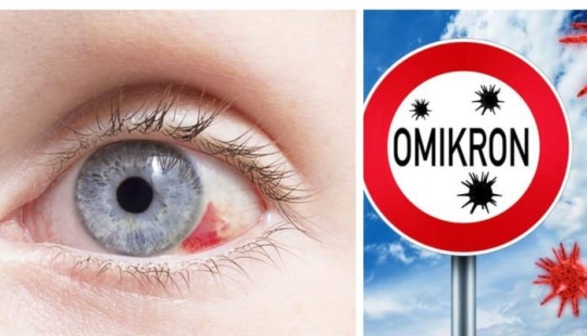 5 main questions about Omicron in children: doctors answer