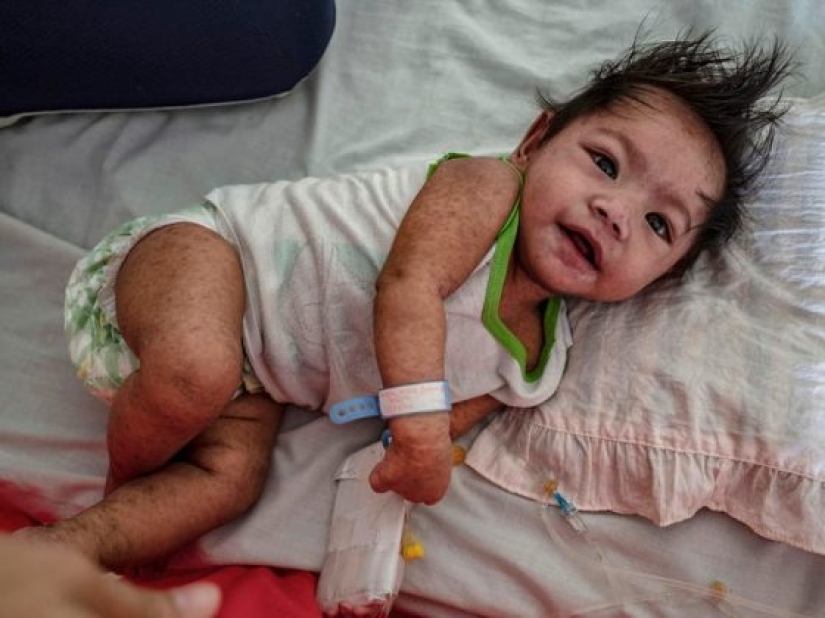 6 dangerous diseases that have returned in the last 10 years