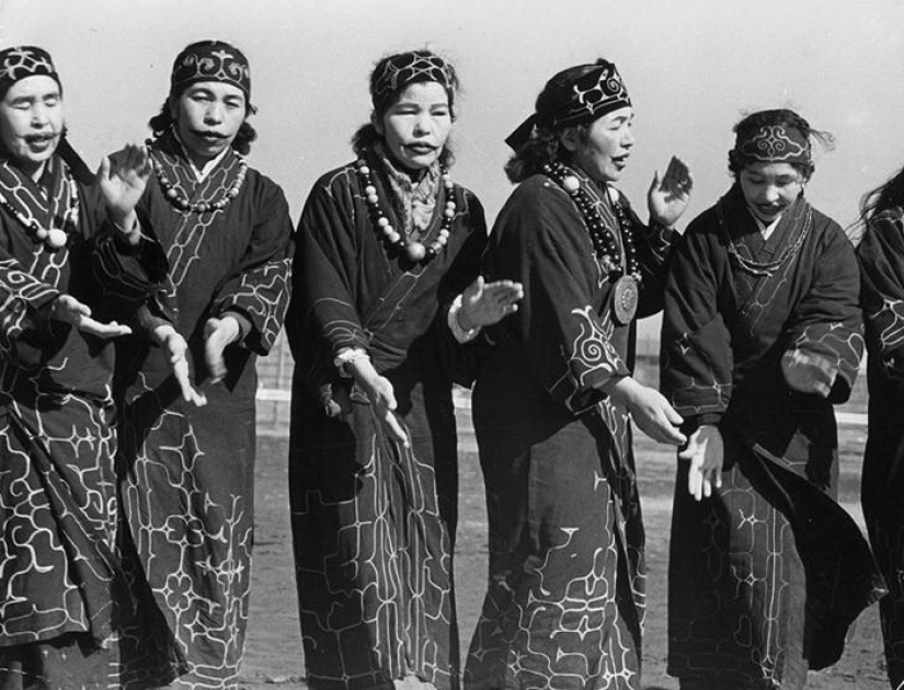 6 de las pruebas más crueles a las que acuden mujeres de diferentes países del mundo por el bien de la belleza