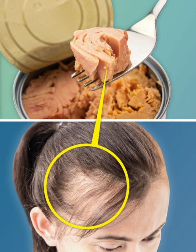 7 daily habits that are killing your hair