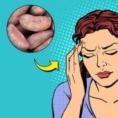 7 foods for migraine