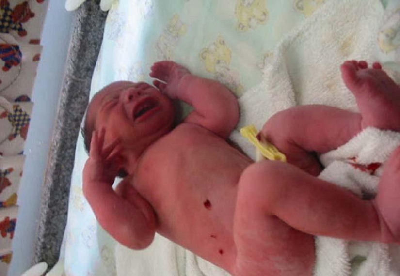 7 incredible stories of infant survival 7 incredible stories of infant survival