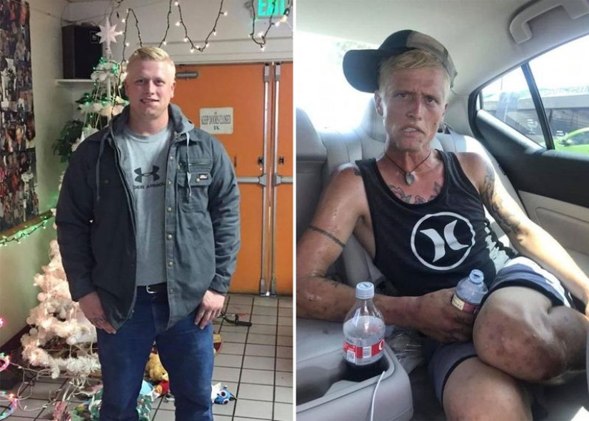 7 months of heroin addiction and its terrible consequences: mother showed shocking photos of her son 7 months of heroin addiction and its terrible consequences: mother showed shocking photos of her son
