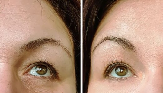 7 reasons to eat a spoonful of olive oil first thing in the morning