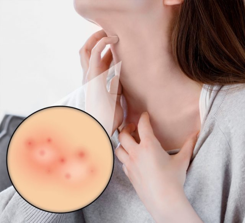 7 signs you need to stop drinking milk