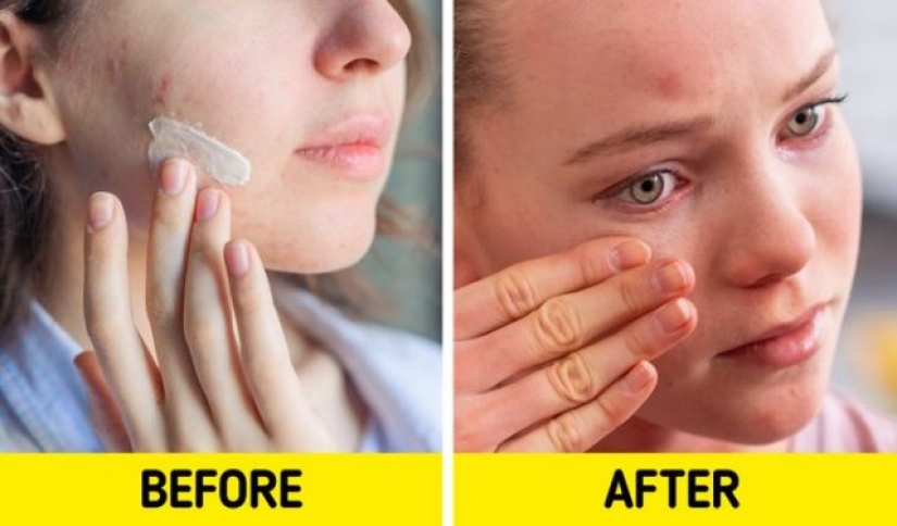 7 skin care products that can harm your skin