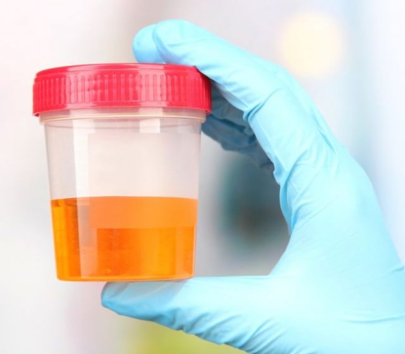 9 Crazy Things Used As Currency Around The World