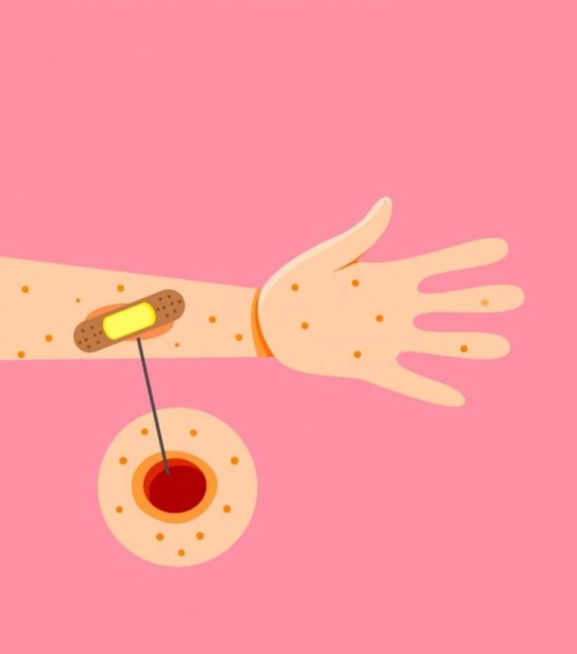 9 primeros síntomas de la diabetes