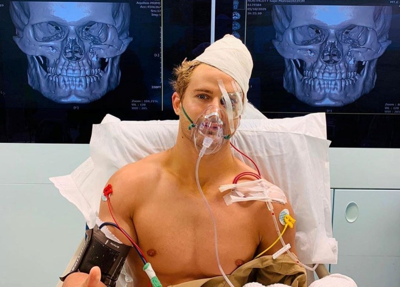 A 29-second battle: eight fractures and a skull like a hundred-year-old mummy