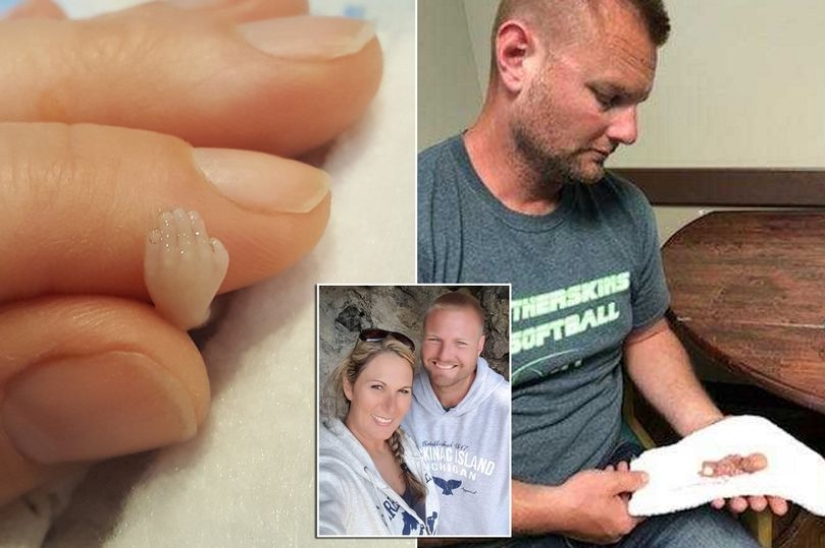 A child or a biomaterial? An American woman has published a photo of her stillborn son