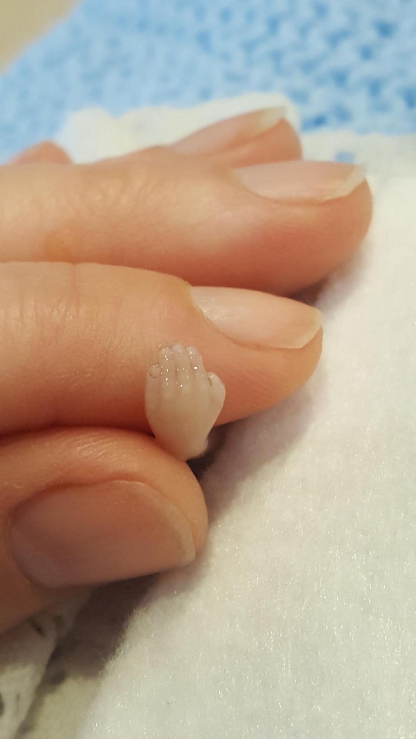 A child or a biomaterial? An American woman has published a photo of her stillborn son