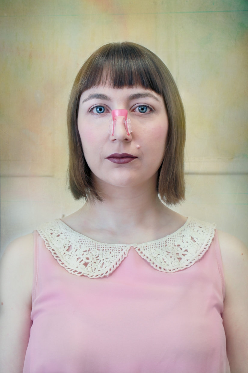 A clothespin on the nose and duck lips: what women are ready for for the sake of beauty and youth