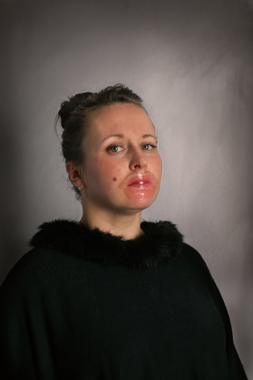 A clothespin on the nose and duck lips: what women are ready for for the sake of beauty and youth