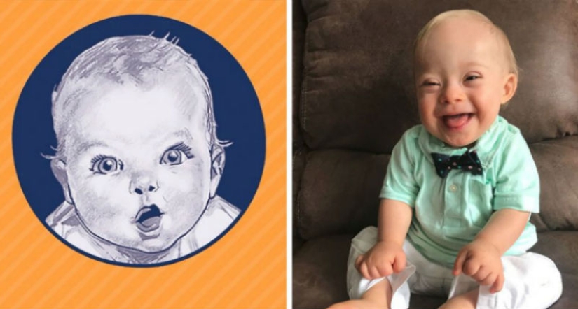 A kid with Down syndrome conquered Gerber with his smile and became the face of a baby food company A kid with Down syndrome conquered Gerber with his smile and became the face of a baby food company