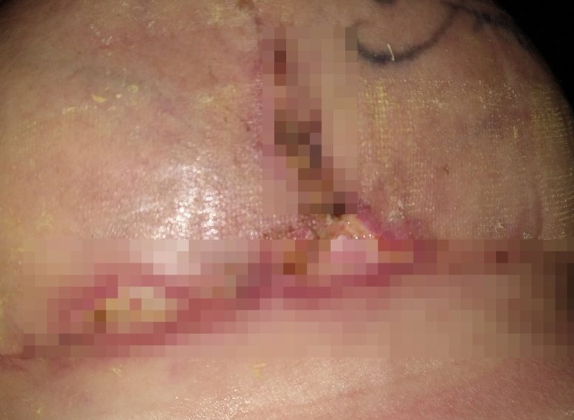 A la mujer americana le agrandaron los senos, la levantaron y le hincharon los labios en lugar de reducir su busto