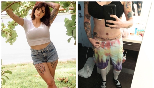 A la mujer americana le agrandaron los senos, la levantaron y le hincharon los labios en lugar de reducir su busto A la mujer americana le agrandaron los senos, la levantaron y le hincharon los labios en lugar de reducir su busto