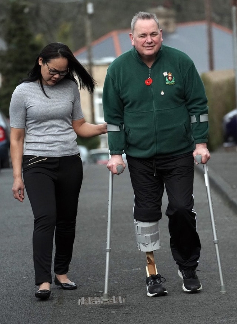 A new leg with her own hands: a woman made a prosthesis for her husband from improvised materials A new leg with her own hands: a woman made a prosthesis for her husband from improvised materials