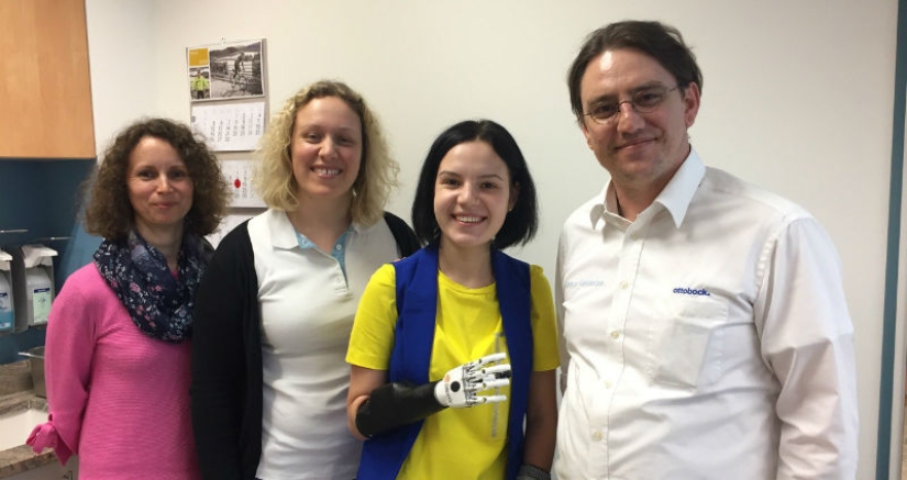 A Russian woman, whose husband cut off her hands out of jealousy, had a bionic prosthesis made