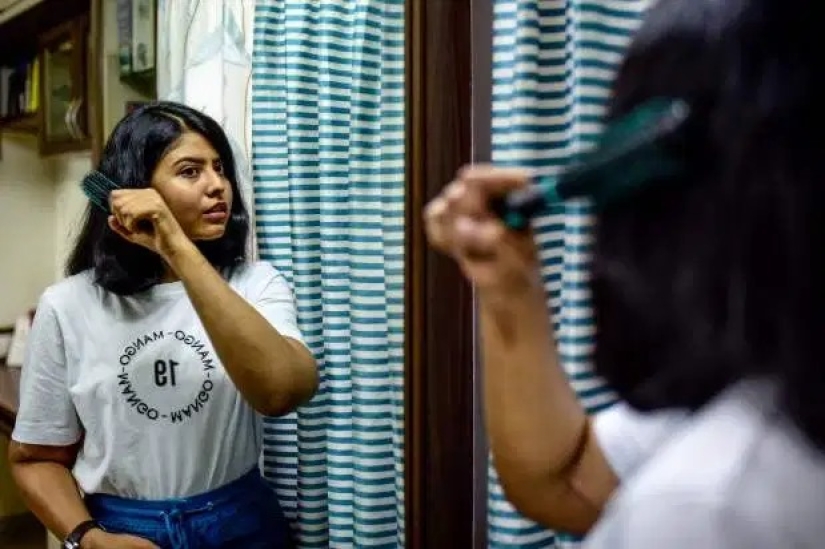 A una niña de la India le trasplantaron manos masculinas, un año después se aclararon y perdieron el cabello