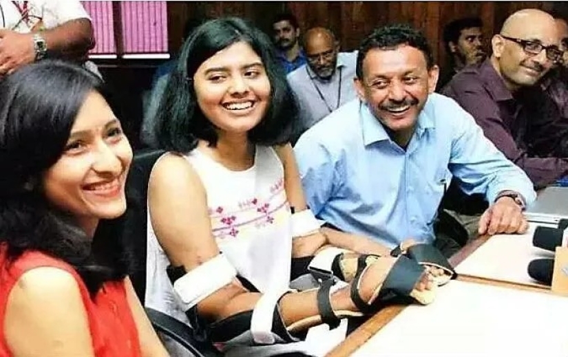 A una niña de la India le trasplantaron manos masculinas, un año después se aclararon y perdieron el cabello