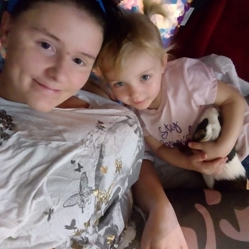 A woman with a 13th breast size told about her suffering A woman with a 13th breast size told about her suffering