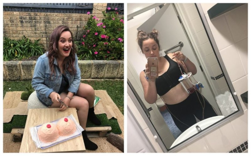 Adiós, tetas! Las chicas organizaron una fiesta para una amiga a la que le extirparon los senos debido a la amenaza de cáncer Adiós, tetas! Las chicas organizaron una fiesta para una amiga a la que le extirparon los senos debido a la amenaza de cáncer