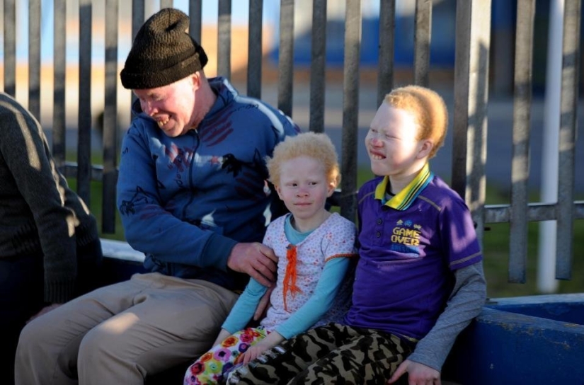 African albinos do not hide their fears African albinos do not hide their fears