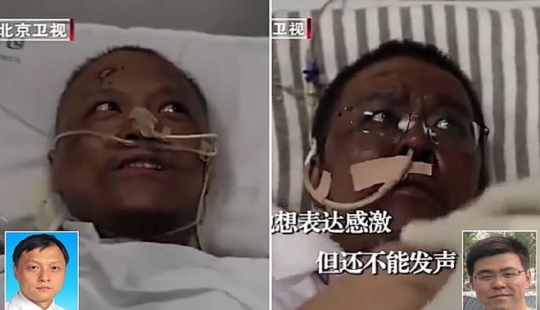 After treatment for coronavirus, doctors from Wuhan became dark-skinned