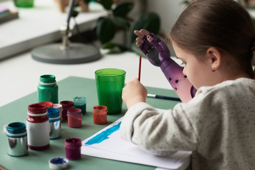 Alice in Wonderland: a little resident of Chelyabinsk was given a cyber hand in Skolkovo